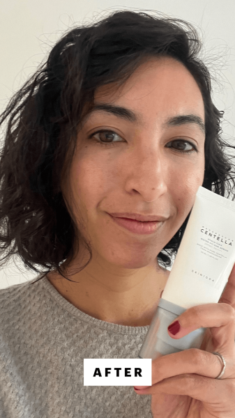 Pai after applying Skin1004 Madagascar Centella HyaluCica WaterFit Sun Serum UV SPF 50